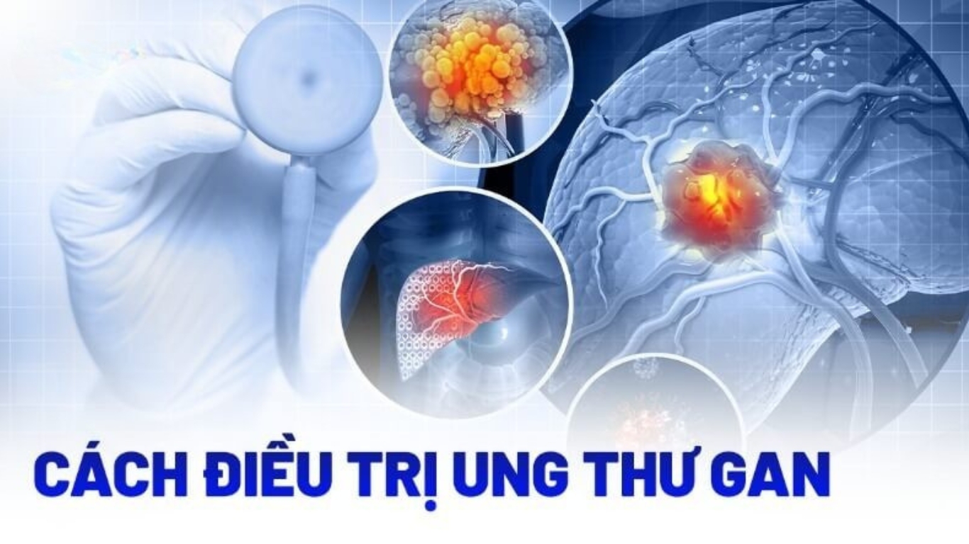 Các Phương Pháp Chữa Ung Thư Gan