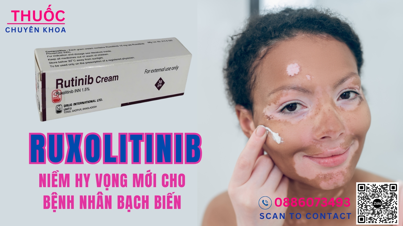 Bệnh Bạch Biến: Hướng Dẫn Toàn Diện Về Nguyên Nhân, Triệu Chứng và Các Phương Pháp Điều Trị Hiệu Quả Nhất 2025 BACH BIEN VUNG DA TAY 6