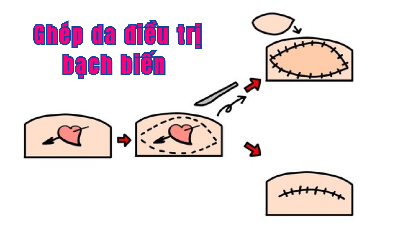 BACH BIEN VUNG DA TAY 7