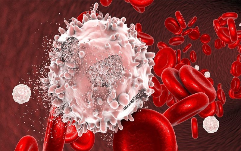 ung thu mau nguyen nhan dau hieu va cac phuong phap chua tri 1 800x450 1