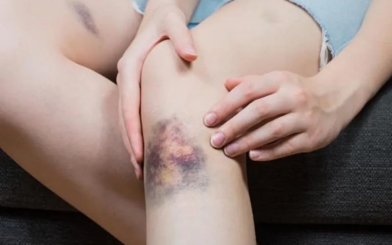 ung thu mau nguyen nhan dau hieu va cac phuong phap chua tri 2 800x450 1